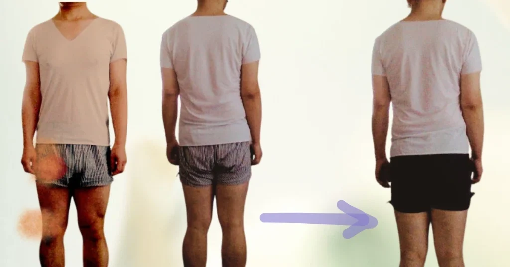 矯正前→矯正スクワット(全40回前後)後